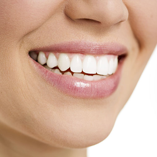 Teeth Whitening Germiston | Cleansmile